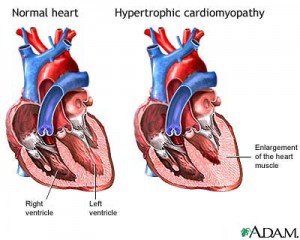 HCOM | Cardiac Health