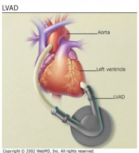 Dick Cheney and modern heart failure treatment | Cardiac Health