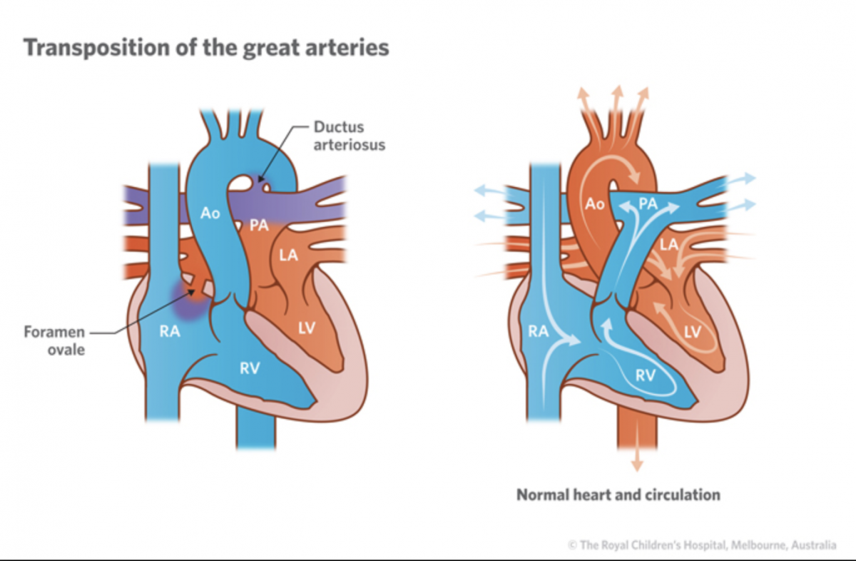 Screenshot 2018-08-27 09.23.03 | Cardiac Health